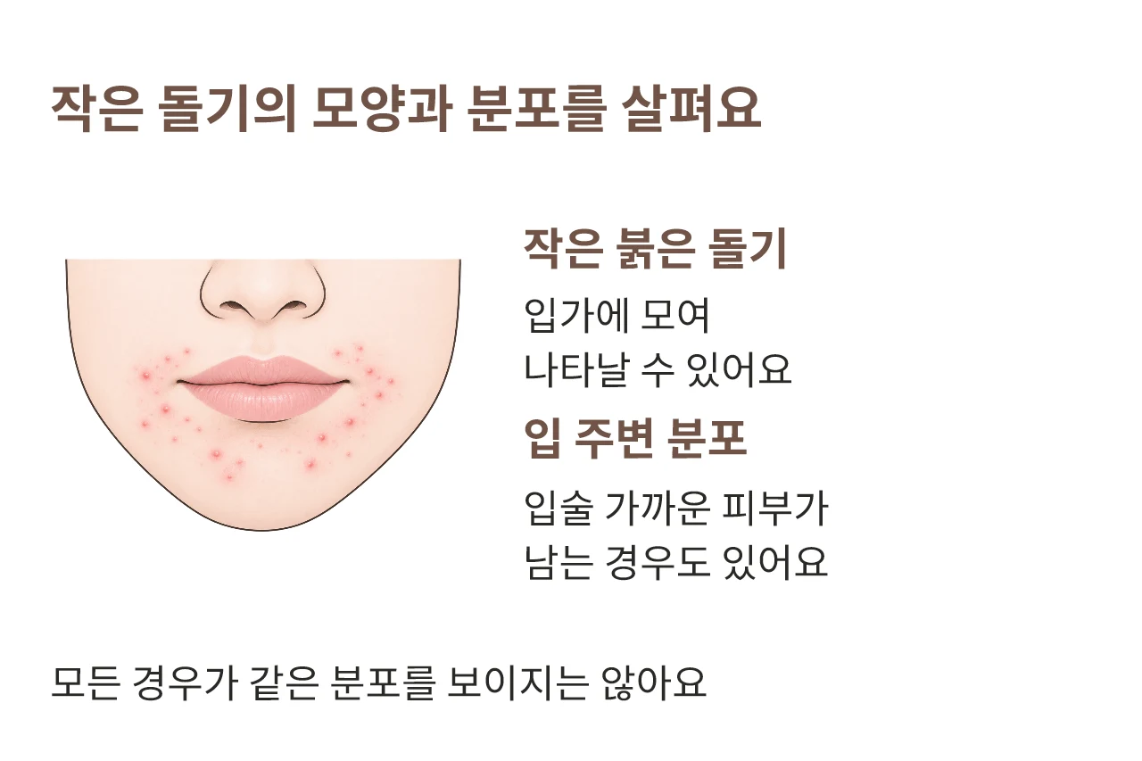 입 주변에 나타나는 작은 붉은 돌기의 분포를 설명하는 그림