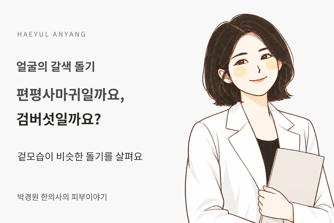 얼굴의 갈색 돌기 칼럼 — 편평사마귀일까요, 검버섯일까요?