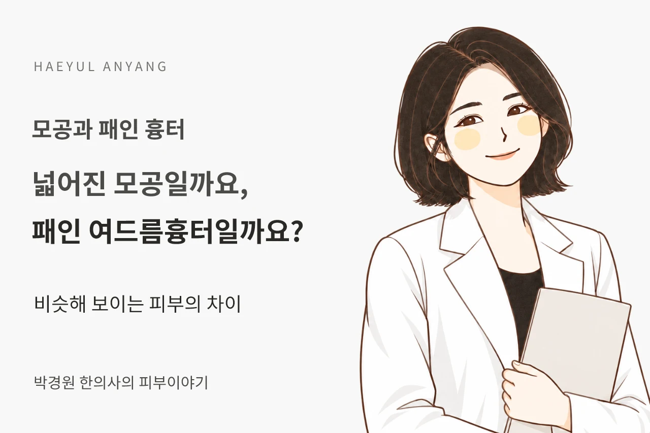 모공과 패인 흉터 칼럼 — 넓어진 모공일까요, 패인 여드름흉터일까요?