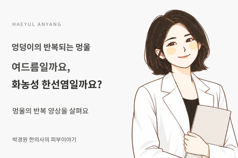 엉덩이의 반복되는 멍울 칼럼 — 여드름일까요, 화농성 한선염일까요?