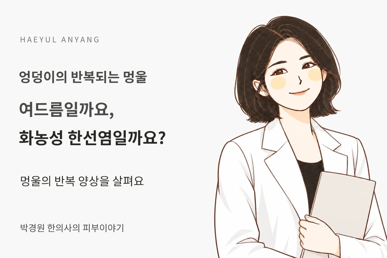 엉덩이의 반복되는 멍울 칼럼 — 여드름일까요, 화농성 한선염일까요?