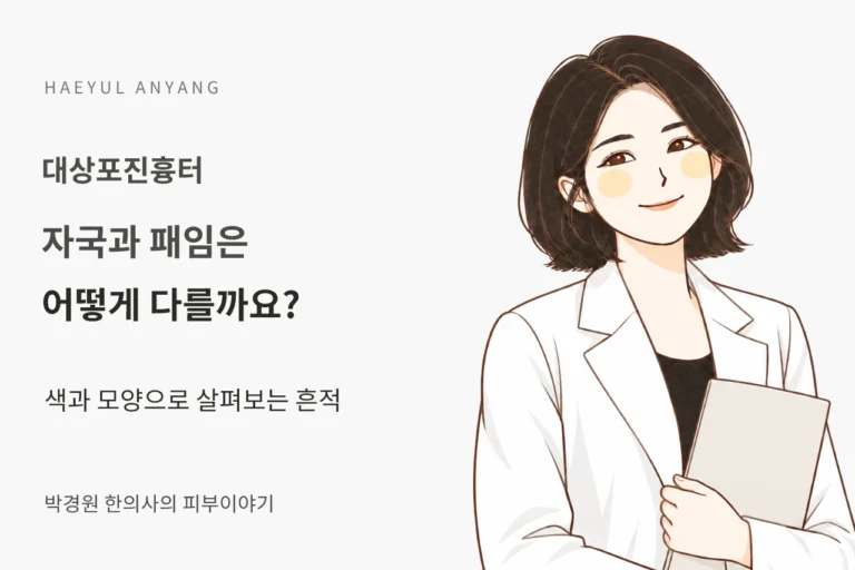 대상포진흉터 칼럼 — 자국과 패임은 어떻게 다를까요?