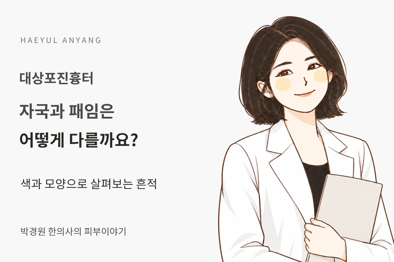 대상포진흉터 칼럼 — 자국과 패임은 어떻게 다를까요?