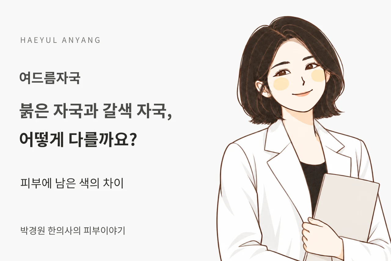 여드름자국 칼럼 — 붉은 자국과 갈색 자국, 어떻게 다를까요?