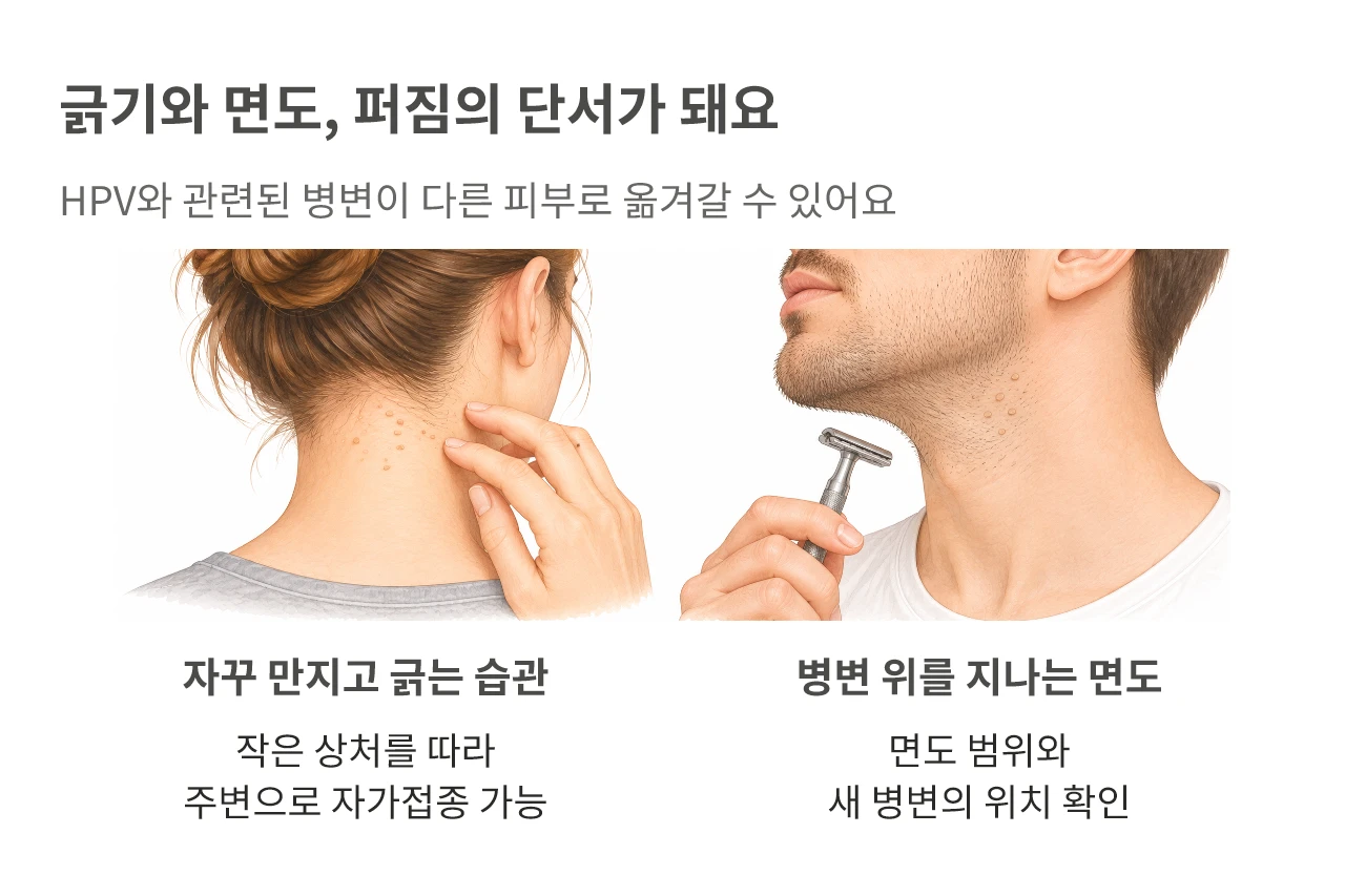 긁기와 면도, 퍼짐의 단서가 돼요. HPV와 관련된 병변이 다른 피부로 옮겨갈 수 있어요