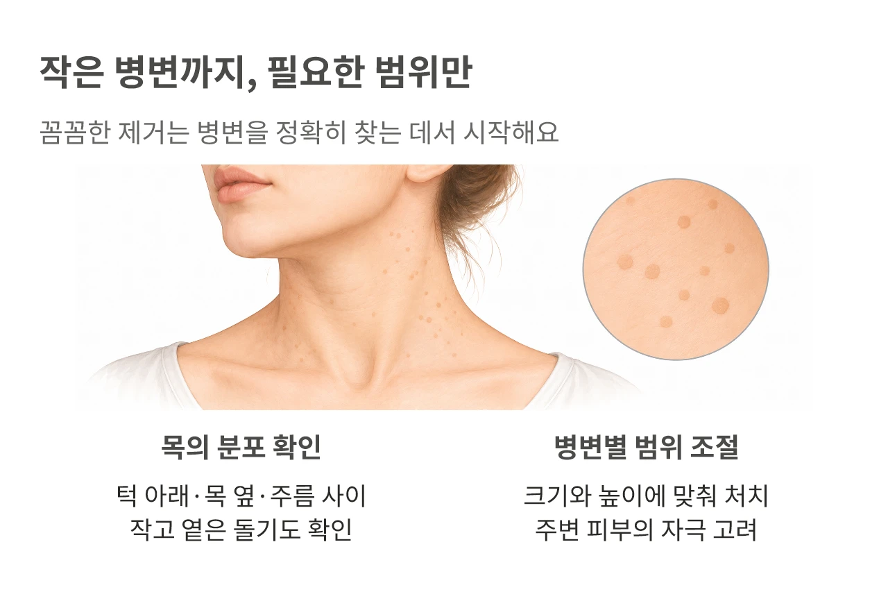 작은 병변까지, 필요한 범위만. 꼼꼼한 제거는 병변을 정확히 찾는 데서 시작해요
