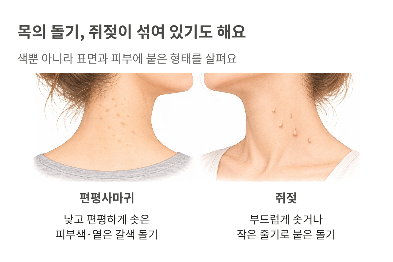 목의 돌기, 쥐젖이 섞여 있기도 해요. 색뿐 아니라 표면과 피부에 붙은 형태를 살펴요