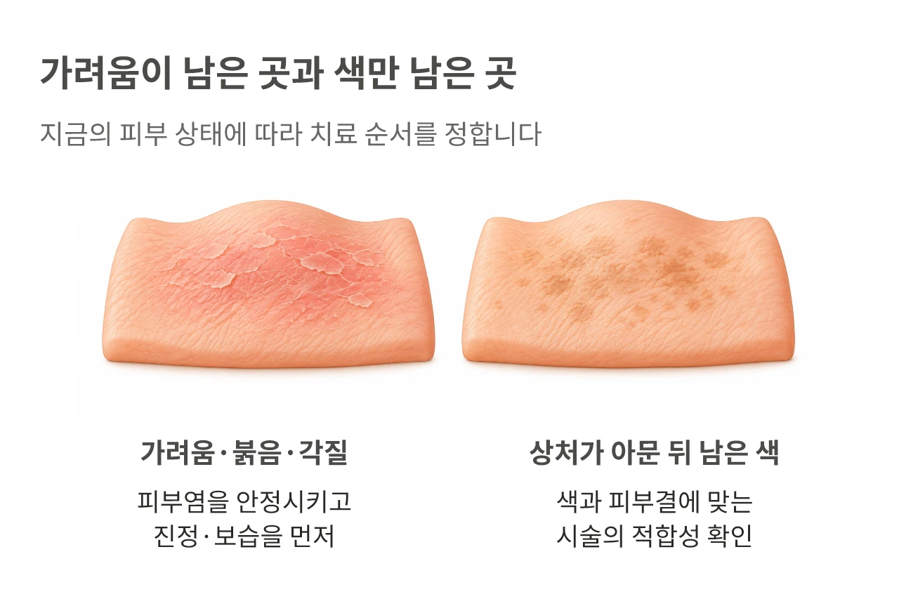 가려움이 남은 곳과 색만 남은 곳. 지금의 피부 상태에 따라 치료 순서를 정합니다