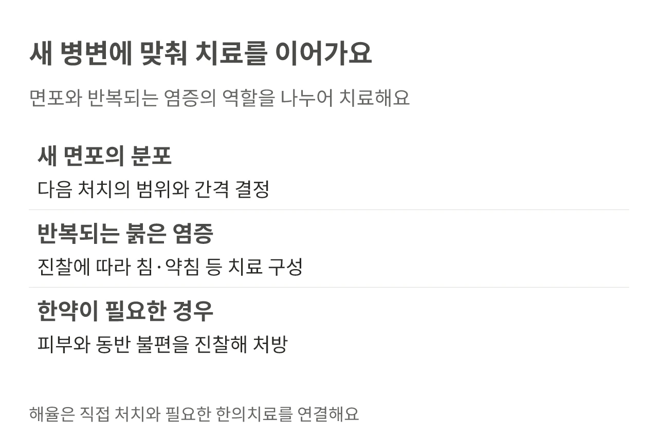 새 병변에 맞춰 치료를 이어가요. 면포와 반복되는 염증의 역할을 나누어 치료해요