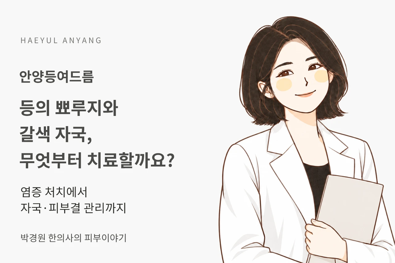 안양등여드름, 뾰루지와 갈색 자국이 섞인 등은 무엇부터 치료할까요?