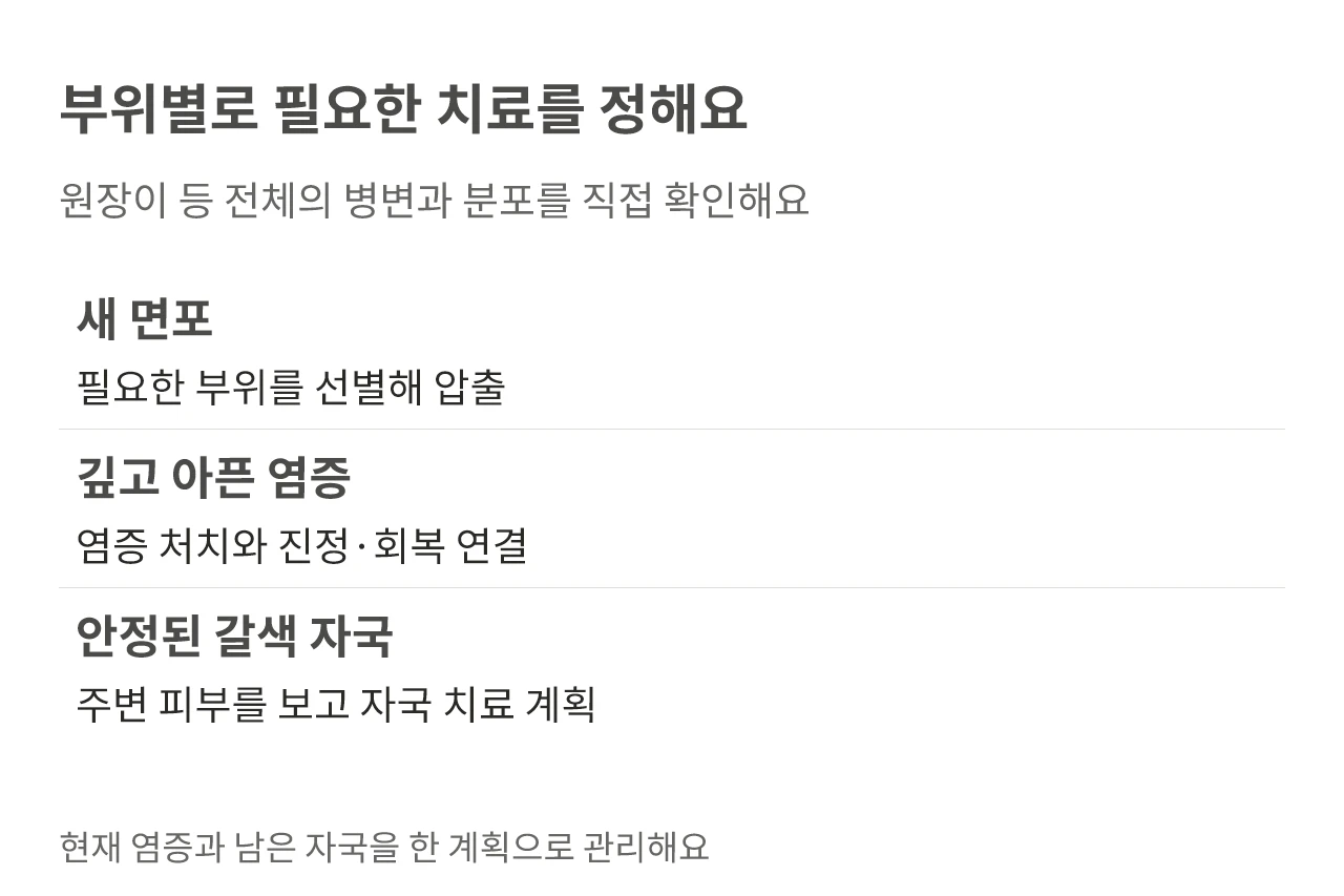 부위별로 필요한 치료를 정해요. 원장이 등 전체의 병변과 분포를 직접 확인해요