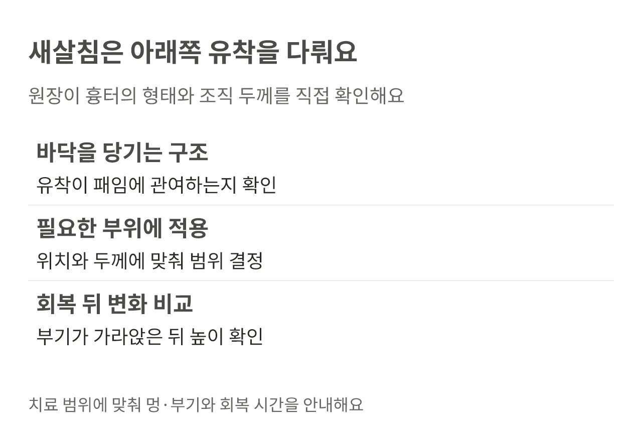 새살침은 아래쪽 유착을 다뤄요. 원장이 흉터의 형태와 조직 두께를 직접 확인해요
