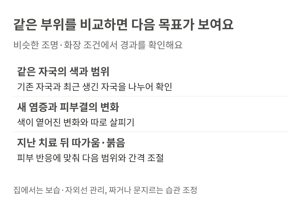같은 부위의 색과 범위, 새 염증과 피부결, 치료 뒤 피부 반응을 확인하는 경과 관리