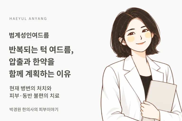 범계성인여드름, 반복되는 턱 여드름에 압출과 한약을 함께 계획하는 이유