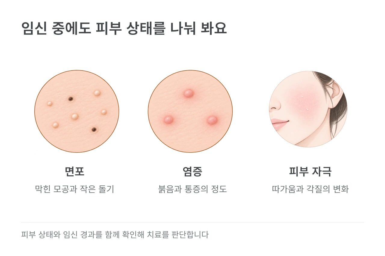 임신 중에도 피부 상태를 나눠 봐요 — 면포·염증·피부 자극