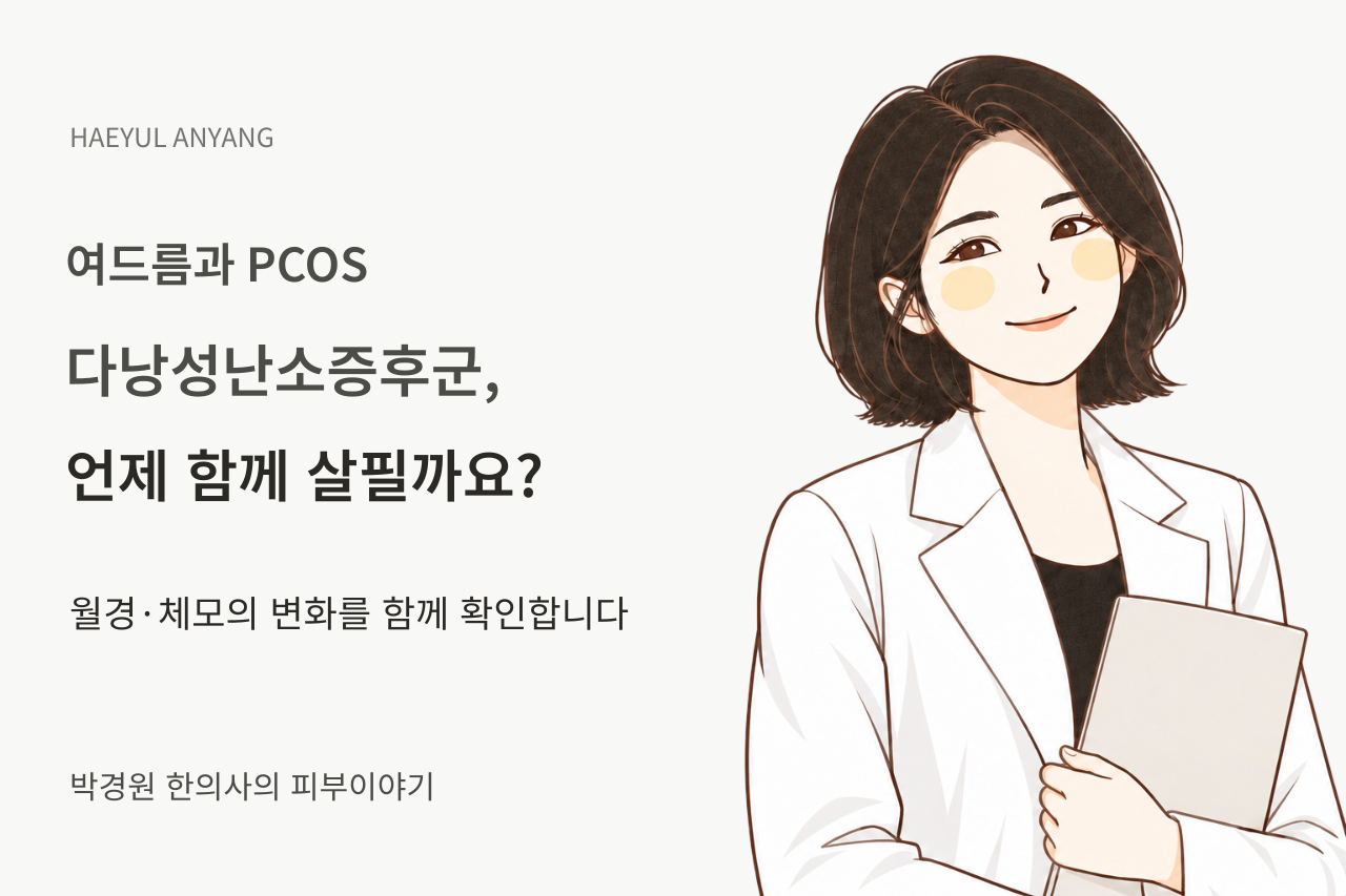 여드름과 다낭성난소증후군, 언제 함께 살필까요?