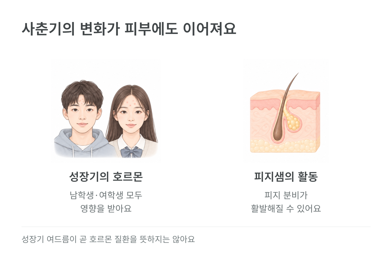 사춘기의 변화가 피부에도 이어져요 — 성장기의 호르몬 남학생·여학생 모두 영향을 받아요; 피지샘의 활동 피지 분비가 활발해질 수 있어요