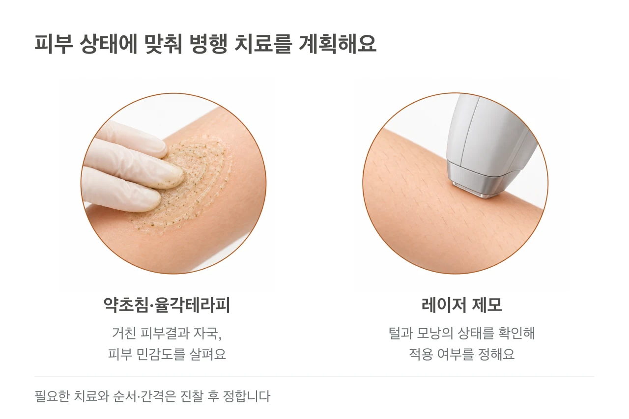 장갑 낀 손으로 팔에 약초필링을 도포하는 과정과 팔의 레이저 제모를 각각 보여주는 그림.